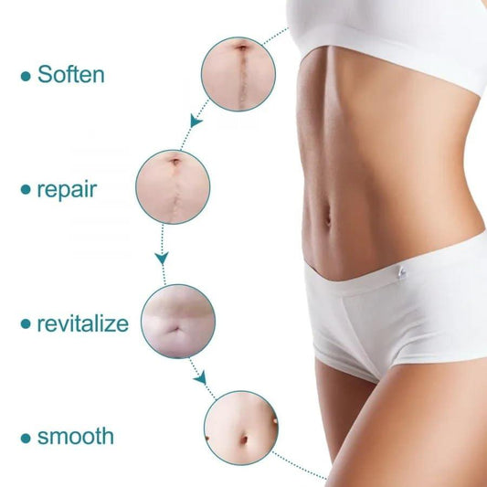 Scar Removal Tape Scar Removal Sheet Strips for C-Section, Acne Scars, Tummy Tuck, Keloid and Surgical Scars, Reusable Medical Grade Silicone Scar Tape, Get Scars Away Painless